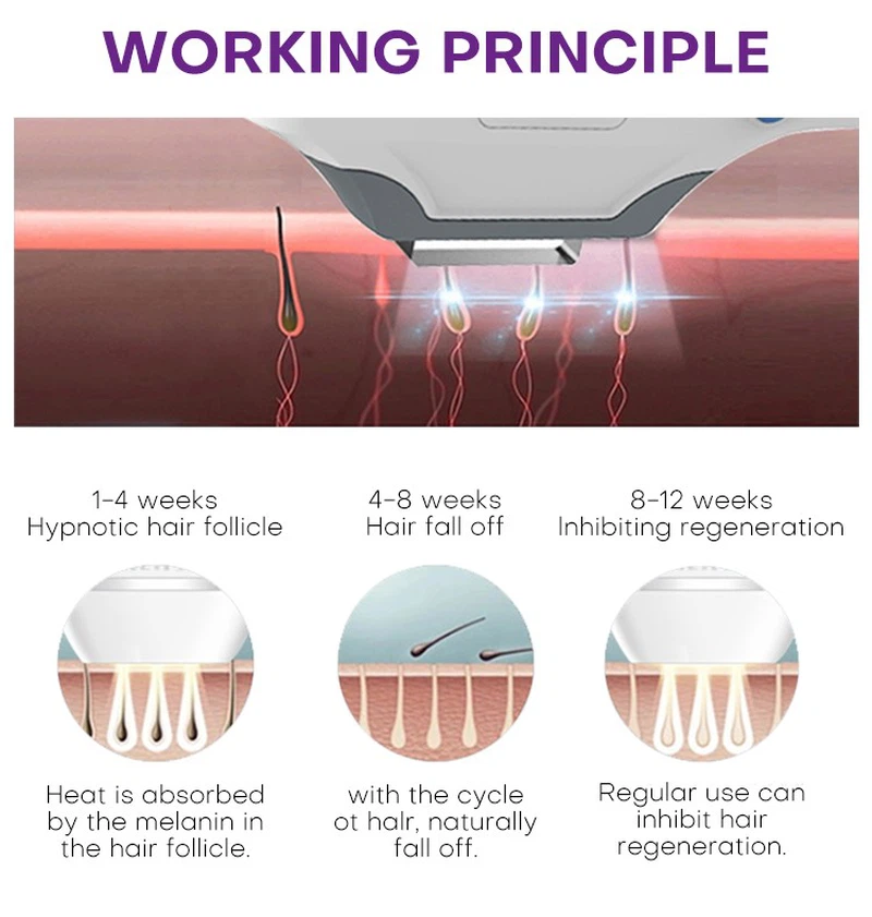 IPL Hair Removal and Skin Rejuvenation Machine IPL Hair Removal and Skin Rejuvenation Machine